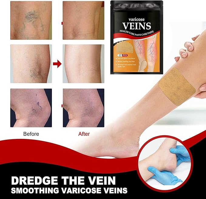 VeinRelief™ Herbal Therapy Patches Pack of 12 Pcs